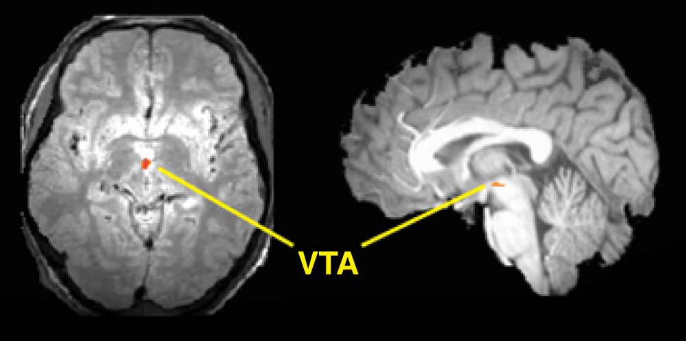 Resultado de imagen de area ventral tegmental